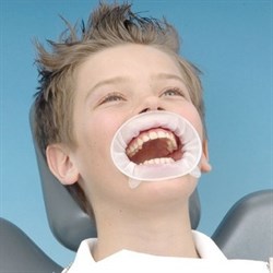 OPTRAGATE JUNIOR ДЕТСКИЙ, 1ШТ., IVOCLAR 0001912501 - фото 26105