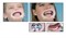 OPTRAGATE АССОРТИ: REGULAR, OPTRAGATE SMALL (40+40ШТ), IVOCLAR 0000910753 - фото 26108